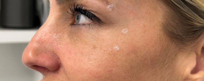 Pur Skin Médico Esthétique
